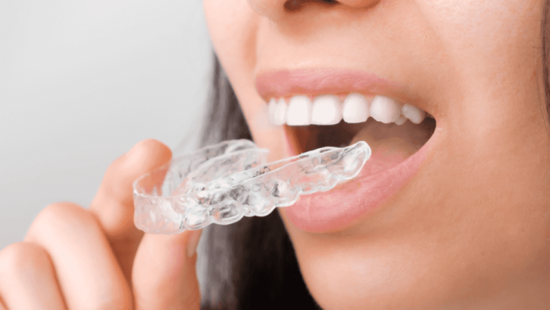 Transforming Smiles: The Latest Innovations in Dental Braces